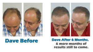 Orlando Hair MD before after photo