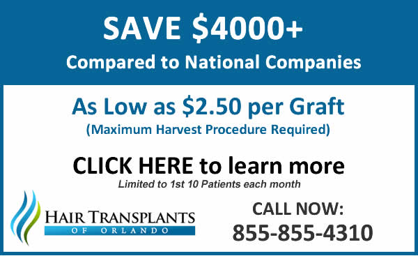 Save $1000 on hair transplants